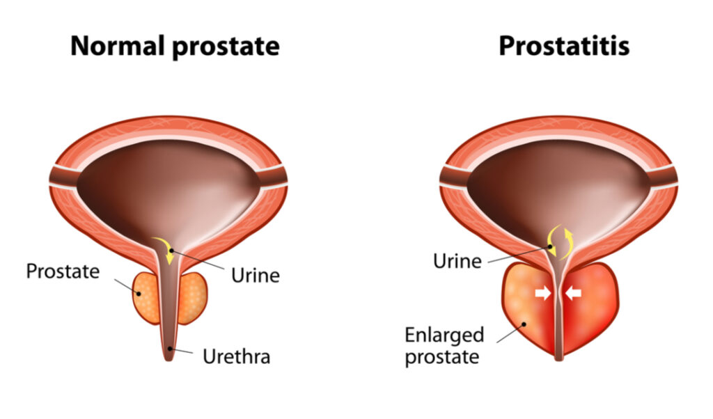 Curated visual reference: How To Diagnose Canine Prostate Problems Reference: Prostate Problem In Dogs Symptoms Causes Treatments