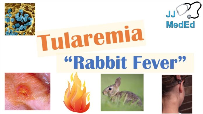 TULAREMIA IN RABBIT