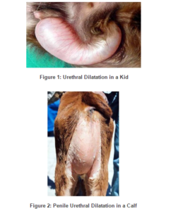 UROLITHIASIS