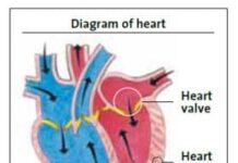 heart disease