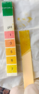 Fig 2: pH of the fluid was acidic in nature