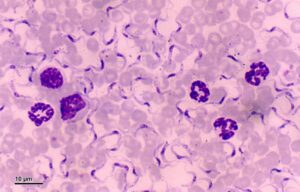 Trypanosoma equiperdum under microscope