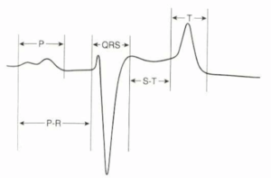 Electrocardiography 