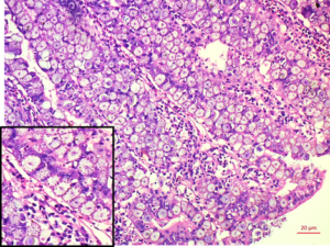 Coccidiosis in chicken