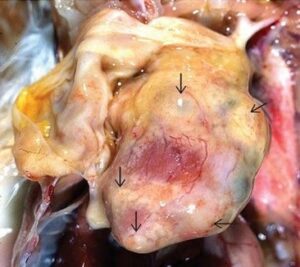 Figure 5 Nodular lesions in heart caused by chronic infection; note thickened pericardium (arrows)